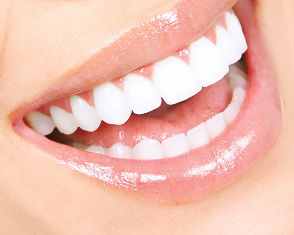 ابتسامة هوليود